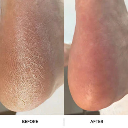 Glyssa SmoothFeet 360 Pro