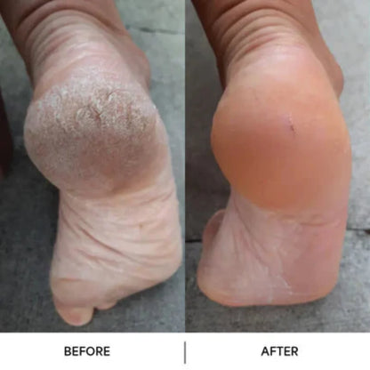 Glyssa SmoothFeet 360 Pro