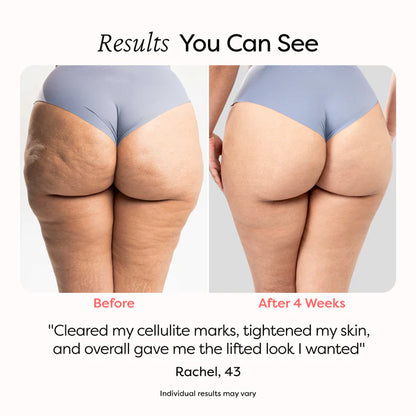 Glyssa Smooth Cellulite Roller