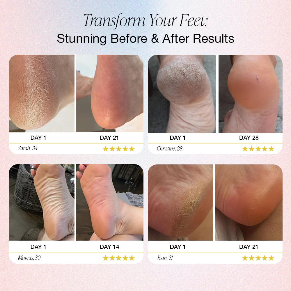 Glyssa SmoothFeet 360 Pro
