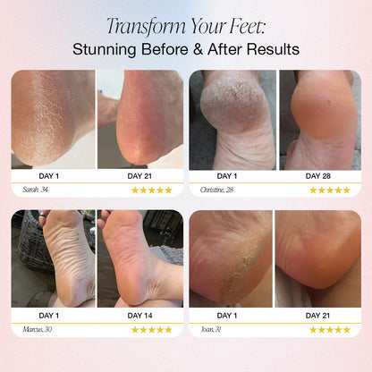 Glyssa SmoothFeet 360 Pro
