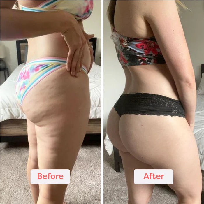 Glyssa Smooth Cellulite Roller