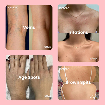 Glyssa Body Coverage Foundation