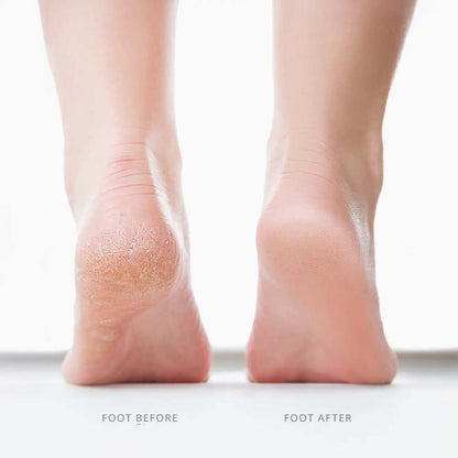 Glyssa SmoothFeet 360 Pro