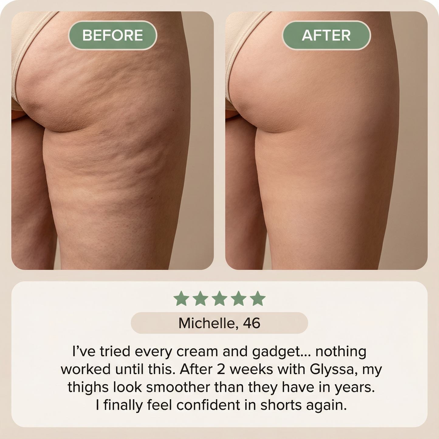 Glyssa Smooth Cellulite Roller